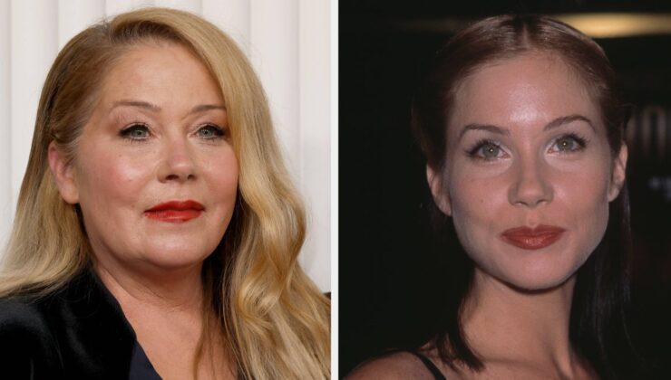 Christina Applegate Eleştirilerden Sonra Estetik Cerrahi Hakkında Konuştu