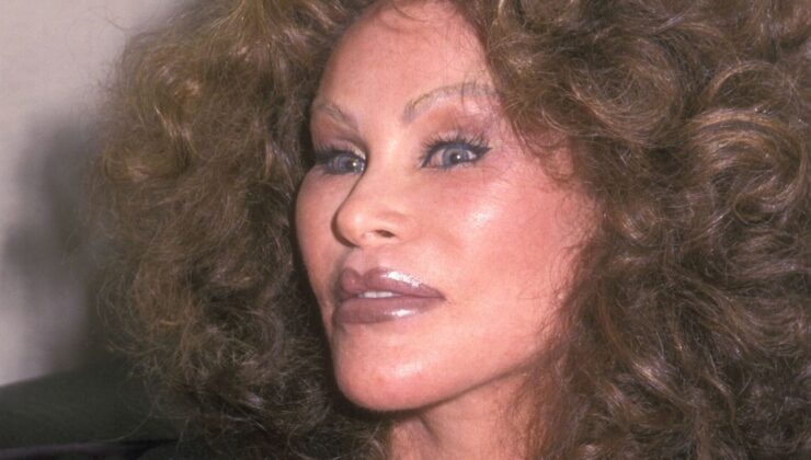 ‘Catwoman’ Jocelyne Wildenstein ameliyat öncesi eski bir kareyi paylaştı – ABD Haberleri – Haberler